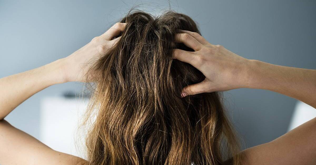 How to Relieve Itchy Scalp Scripps Health