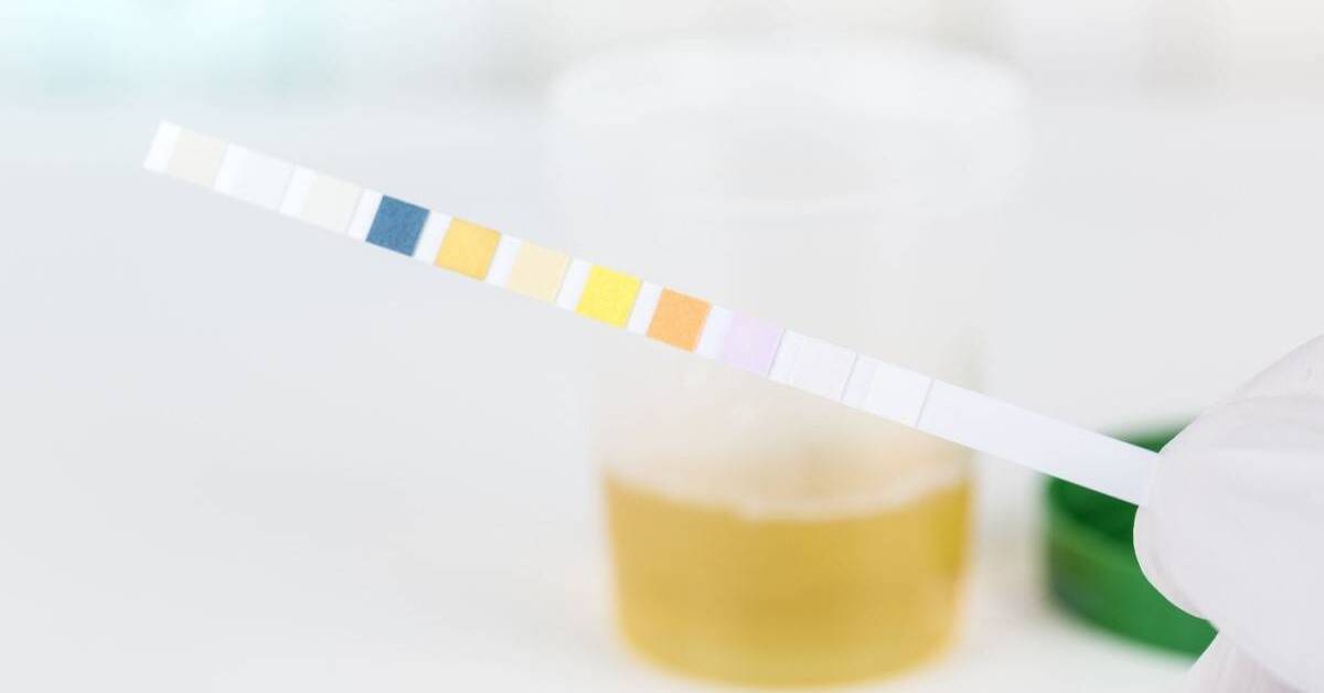 Urine Color Guide: What It Says About Your Health - Scripps Health