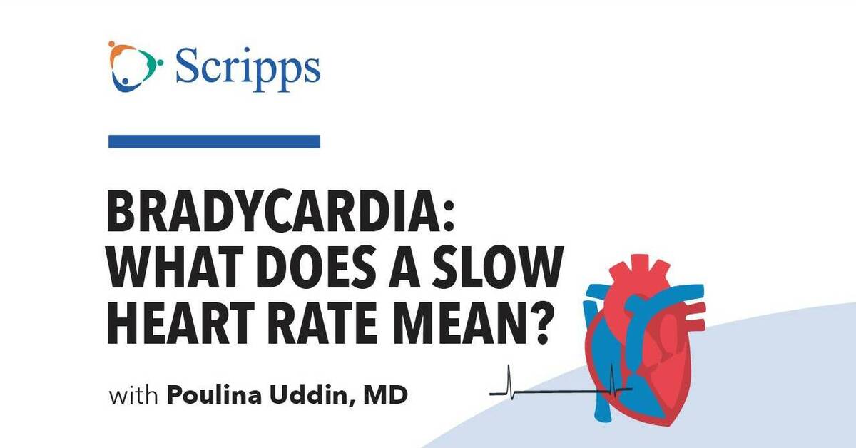 What Is Bradycardia? (video) Scripps Health
