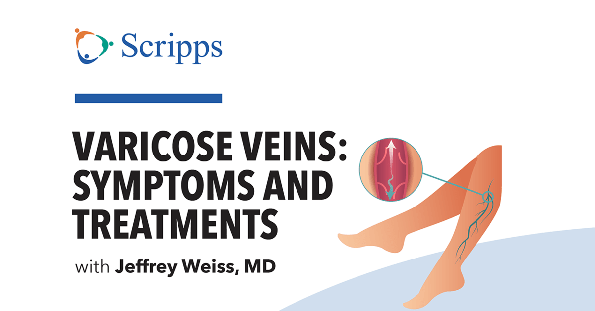 How Do Your Get Rid of Varicose Veins? (video) Scripps Health