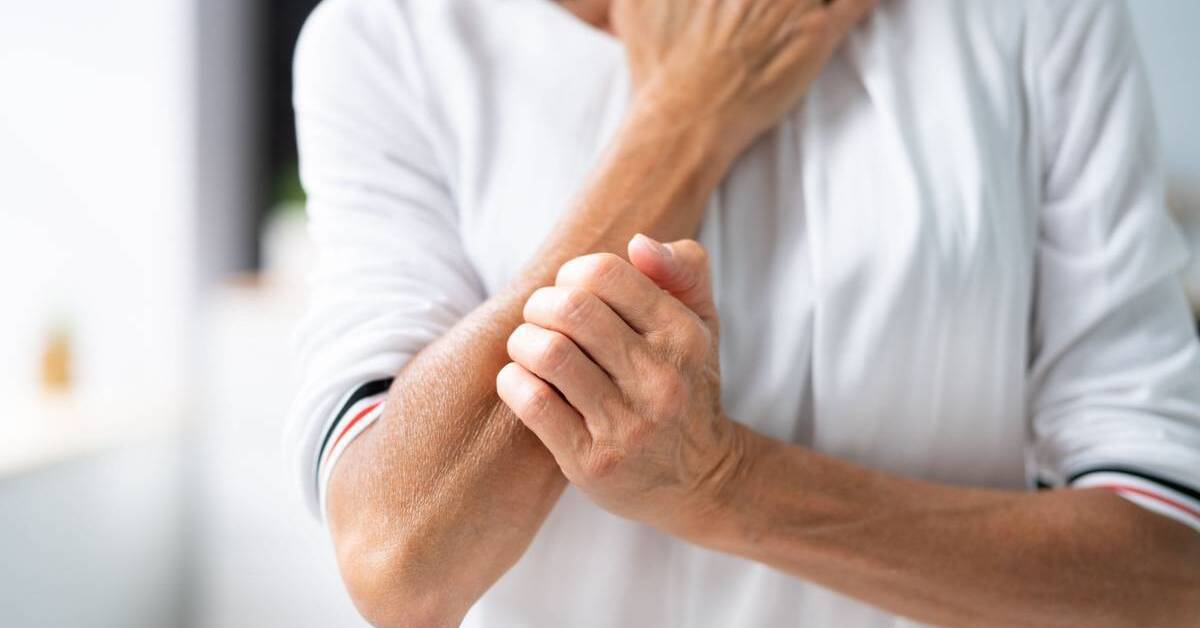 What Type of Cancer Causes Itchy Skin? Scripps Health